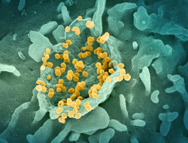 En este artículo exploraré qué es la microbiota, factores la afectan negativamente y cómo puedes mejorarla y qué puedes implementar en tu día a día